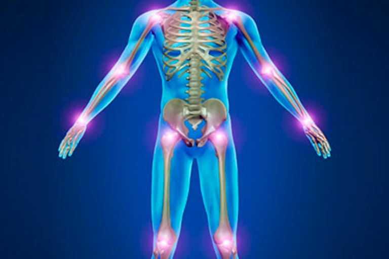 Rheumatology Inflammatory Care