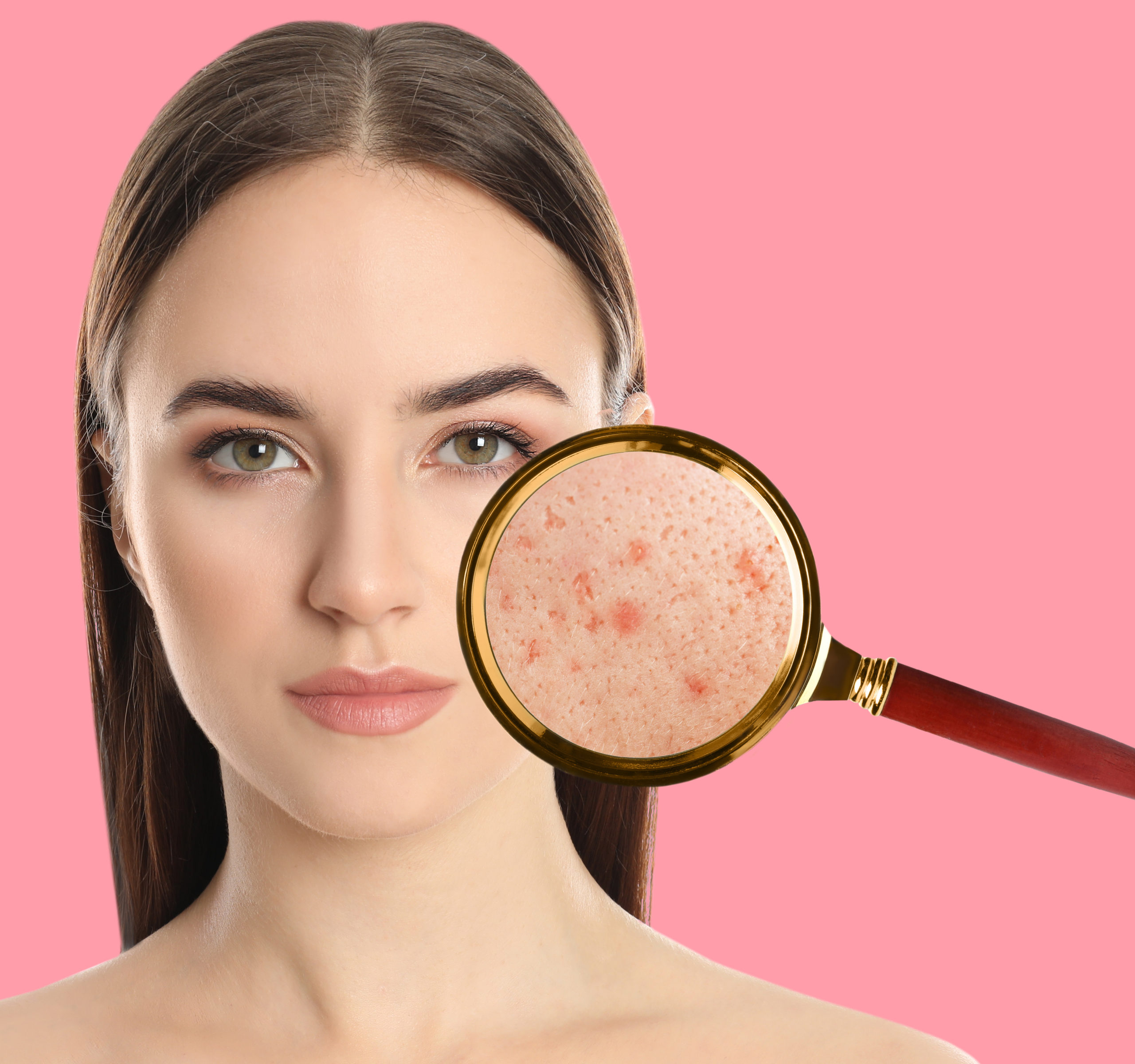 Skin Related Concerns